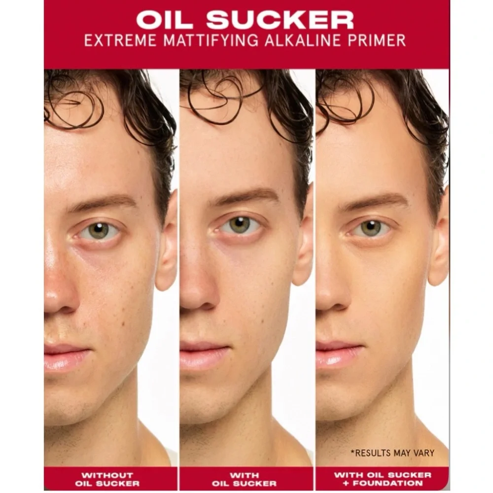 NEW✅ONE/SIZE Oil Sucker